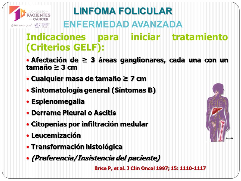 Que es un linfoma folicular